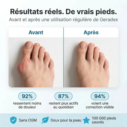 Correcteur Hallux Pro™ – Le plaisir de remarcher sans douleur. Dans les chaussures que vous aimez vraiment.